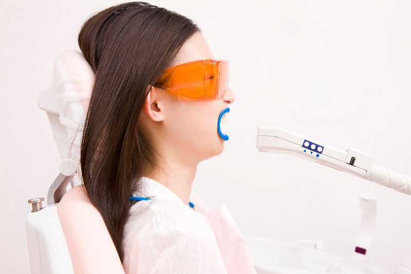 オフィスホワイトニング―歯医者で行うホワイトニング